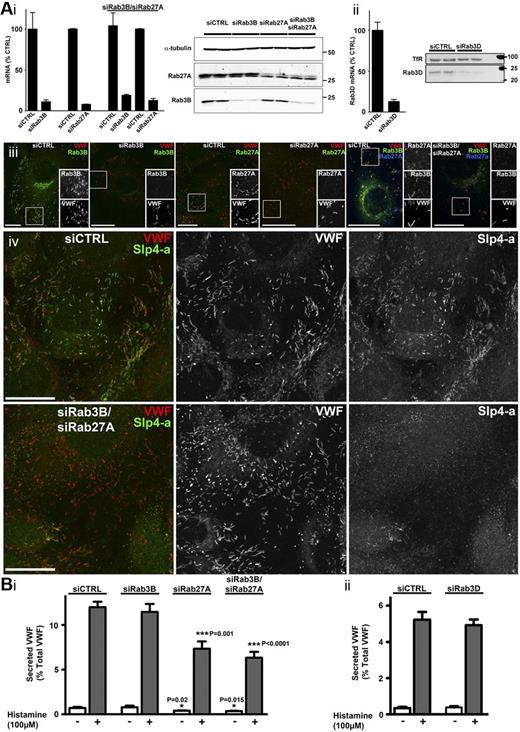 Figure 5. KD of Rab27A, but not of Rab3B or Rab3D, decreases hormone-evoked VWF secretion. (Ai-ii) Quantification of mRNA and protein after nucleofection with either control (siCTRL) or specific KD oligos as indicated. mRNA KD were Rab3B (89% ± 2%), Rab27A (92% ± 0.4%), Rab3B/Rab27A (81% ± 1%/87% ± 2%), and Rab3D (87% ± 2.6%). Data were pooled from 3-5 independent experiments. Representative immunoblots are shown. Position of molecular weight markers (kDa) are shown to the right; α-tubulin (Ai) or transferrin receptor (TfR, Aii) were used as loading controls. (Aiii) Four left panels: Immunostainings of HUVECs for endogenous Rab3B (mouse Ab, green) or Rab27A (mouse Ab, green) and VWF (sheep Ab, red) in control or KDs as indicated. Two right panels: Immunostainings of HUVECs for Rab3B (mouse Ab, green), Rab27A (rabbit Ab, blue), and VWF (sheep Ab, red). Grayscale images are from regions indicated by white boxes. Scale bars represent 20 μm. (Aiv) Immunostainings of HUVECs for Slp4-a (rabbit Ab, green in color merge on left) and VWF (sheep Ab, red in color merge on left) in control (top) or Rab3B/Rab27A KD (bottom). Scale bars represent 20 μm. (B) Histamine-evoked VWF secretion from HUVECs nucleofected with control or specific siRNA oligos for Rab3B, Rab27A, or Rab3B/Rab27A (Bi), or Rab3D (Bii) as indicated. Open bars represent control (vehicle alone); and gray bars, histamine stimulation. Data were pooled from 3 independent experiments. There was no significant difference in VWF secretion between Rab27A KD and Rab3B/Rab27A KD (P = .26). Compared with siCTRL, basal secretion of VWF was significantly lower in Rab27A (P = .02) or Rab27A/Rab3B (P = .015) KD experiments.