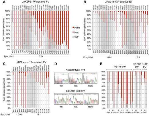 Figure 1. Proportions of JAK2 genotypes in BFU-Es from patients with JAK2-mutated PV and ET. Each vertical bar represents 1 patient, divided according to the proportion of wild-type, heterozygous, and homozygous-mutant colonies obtained, with the absolute colony numbers shown above (WT/Het/Hom). BFU-E colonies were grown under low erythropoietin conditions as indicated. (A) Colony genotypes for 30 patients with JAK2V617F-positive PV (total 2287 colonies; mean 76 colonies per patient). (B) Colony genotypes for 29 patients with JAK2V617F-positive ET (total 2277 colonies; mean 79 per patient). (C) Colony genotypes for 18 patients with JAK2 exon 12-mutated PV (total 1931 colonies; mean 107 per patient). (D) Example sequence traces for patients with patients with homozygous JAK2 exon 12 mutations in colonies. (E) Examples of patients grown on 2 occasions show reproducibility of genotype proportions in JAK2V617F-positive PV, JAK2V617F-positive ET, and JAK2 exon 12-mutated PV (1 and 2 represent independent experiments). In total, 16 patients (5 “heterozygous-only” JAK2V617F-positive PV patients, 4 JAK2V617F-positive PV patients with homozygous and heterozygous clones, 3 JAK2V617F-positive ET patients with small homozygous clones, and 4 JAK2 exon 12-mutated PV patients with homozygous clones) were assessed in this way (mean time between experiments, 13 months; range, 2-32 months) and showed reproducibility of proportions of heterozygous and homozygous-mutant colonies.