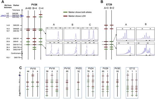 Figure 2. Microsatellite mapping of 9p LOH in JAK2V617F-homozygous colonies. (A) Microsatellite mapping of 68 JAK2V617F-homozygous colonies from patient PV26 (patient codes are the same as in Figure 1). The panel of microsatellite markers on chromosome 9 is shown on the left (distances are to scale between the telomere and D9S2148), from which informative markers were selected for each patient. Three patterns of microsatellite markers were observed in colonies from this patient, indicating 3 distinct LOH breakpoints. Each subclone is represented by a vertical line denoted A (60 colonies), B (4 colonies), or C (4 colonies), with markers showing heterozygosity in green and those showing LOH in red. Example traces from fluorescence microsatellite PCR are shown for 2 markers (D9S925 and D9S1817) for the 3 subclones (right), with the position of alleles shown by arrowheads. (B) Microsatellite mapping of 5 JAK2V617F-homozygous colonies from patient ET29. Two patterns of microsatellite markers were observed; example traces are shown for 2 markers (D9S43 and D9S1817) on the right. (C) Microsatellite mapping of JAK2V617F-homozygous colonies in 8 other patients. The panel of markers is the same as in panel A. Numbers of colonies corresponding to each pattern are shown above.