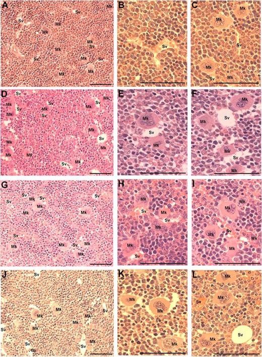 Figure 3. Visualization of MKs in bone marrow sections from mice treated with VEGF-A165, PlGF-2, VEGF-E, or vehicle. Mice were administered either VEGF-A165, PlGF-2, VEGF-E (100 μg/kg intraperitoneally), or vehicle (PBS) daily for 4 consecutive days before femurs were excised for bone marrow histology. (A) Representative photomicrograph of bone marrow stained with toluidine blue reveal the distribution of sinusoidal vessels (Sv) and MKs (Mk) from a PBS-treated mouse. (B-C) Higher-power magnification of femurs from PBS-treated mice showing localization of MKs in relation to sinusoidal vessels and the stroma. (D) Representative photomicrograph of bone marrow from VEGF-A165–treated mouse reveals a more pronounced localization of MKs to sinusoidal vessels. (E-F) Higher-power confirmation of MK localized directly adjacent to sinusoidal vessels. (G-I) Representative photomicrographs of bone marrow from PlGF-2–treated mouse reveals a similar distribution pattern of MKs adjacent to sinusoidal vessels to that of VEGF-A165–treated mice. (J-L) Representative photomicrographs of bone marrow from VEGF-E–treated mouse reveals MKs distributed within the bone marrow stroma, with the occasional MK adjacent to a sinusoidal vessel. (A,D,G,J) Magnification:×40. (B,C,E,F,H,I,K,L) Magnification: ×100. Photomicrographs at ×100 magnification have been turned 90° using Microsoft Powerpoint (to allow photomicrographs to fit inside figure). Bar represents 50 μm.