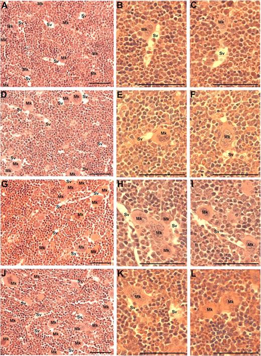 Figure 6. Visualization of MKs in bone marrow sections from mice treated with VEGF-A165 or vehicle and CXCR4 antagonist. Mice were administered either VEGF-A165 (100 μg/kg intraperitoneally) or vehicle (PBS) each day for 4 consecutive days. Some groups of mice were administered a CXCR4 antagonist (AMD3100 5 mg/kg) or PBS b.i.d. (bis in die: twice-daily dosing) for the 4 days of VEGF-A165 treatment. Twenty-four hours after final AMD3100 administration, femurs were excised for bone marrow histology. (A) Representative photomicrograph of bone marrow stained with toluidine blue reveal the distribution of sinusoidal vessels (Sv) and MKs (Mk) from a PBS-treated mouse. (B-C) Higher-power magnification of femurs from PBS-treated mice showing localization of MKs in relation to sinusoidal vessels and the stroma. (D-F) Representative photomicrographs of bone marrow from a PBS + CXCR4 antagonist–treated mouse reveals a similar distribution pattern of MKs within the bone marrow stroma to that of PBS-treated mice. (G) Representative photomicrograph of bone marrow from VEGF-A165 + PBS–treated mouse reveals a more pronounced localization of MKs to sinusoidal vessels. (H-I) Higher-power confirmation of MK localized directly adjacent to sinusoidal vessels. (J-L) Representative photomicrographs of bone marrow from VEGF-A165 + CXCR4 antagonist–treated mouse reveals MKs distributed within the bone marrow stroma, with the occasional MK adjacent to a sinusoidal vessel. (A,D,G,J) Magnification: ×40. (B,C,E,F,H,I,K,L) Magnification: ×100. Photomicrographs at ×100 magnification have been turned 90° using Microsoft Powerpoint (to allow photomicrographs to fit inside figure). Bar represents 50 μm.