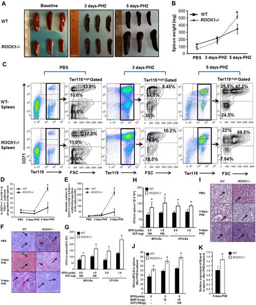 Figure 3. Enhanced stress erythropoiesis in ROCK1-deficient mice. WT and ROCK1−/− mice were treated with PHZ (90 mg/kg at day 0). At the indicated time points, tissues were harvested. (A) Photomicrographs of spleens in the 2 genotypes are shown after PBS and PHZ treatment. (B) Line chart represents mean ± SEM of splenic weight of WT and ROCK1−/− mice after PHZ injection at indicated time points (n = 6 mice per genotype for the 3 day time point; n = 3 mice per genotype for 5 day and PBS time point, *P < .05). (C) Splenocytes from WT and ROCK1−/− mice were analyzed for the expression of erythroid cell surface marker Ter119 and CD71 in combination with forward scatter (FSC) parameter by flow cytometry after PHZ treatment. A representative left dot blot shows the Ter119high-positive erythroblasts in the spleen at indicated each time points. Ter119high-positive erythroblasts were further analyzed for CD71 expression and FSC parameter as seen in right contour plots at each time point. Percentages in top-right quadrant contour represents CD71high, Ter119high, and FSChigh; percentages in top-left quadrant represents CD71high, Ter119high, and FSClow; percentages in bottom-left quadrant represents CD71low, Ter119high, and FSClow erythroblast in spleen. (D) Line chart representing the mean ± SEM of CD71high,Ter119high, and FSChigh erythroid subset in the spleen of WT and ROCK1−/− mice after PHZ injection at the indicated time points. For each analysis (n = 3 mice per genotype for the 3 day time point; n = 3 mice per genotype for the 5 day and PBS time point, *P < .05). (E) Line graph representing the mean ± SEM of CD71high, Ter119high, and FSChigh erythroid subset in the spleen of WT and ROCK1−/− mice after PHZ injection at the indicated time points. For each analysis (n = 3 mice per genotype for the 3 day time point; n = 3 mice per genotype for the 5 day and PBS time point, *P < .05). (F) Histopathologic analysis of WT and ROCK1−/− spleens after PHZ treatment. Spleens were harvested at indicated time points, fixed in 10% buffered formalin, sectioned, and stained with hematoxylin and eosin. Shown are representative spleen sections from WT and ROCK1−/− mice after PHZ treatment. Arrows in left panel indicate clearly defined architecture of white pulp and red pulp in WT spleen 3 and 5 days after PHZ treatment. Arrows in right panel indicate enhanced extramedullary erythropoiesis in ROCK1−/− spleens after PHZ treatment (n = 3 mice per genotype for each time point). (G) Splenocytes (5.0 × 104) from WT and ROCK1−/− mice were plated in a methylcellulose colony-forming assay in the presence of the indicated concentration of SCF and EPO. Colonies were enumerated on day 2 (for CFU-E) and on day 10 (for BFU-E). Bar graph represents the mean ± SD of colonies from 3 independent mice for each genotype 3 days after PHZ treatment plated in triplicates (*P < .05, ROCK−/− vs WT). (H) Bar graph indicates the mean ± SD number of colonies from WT and ROCK1−/− splenocytes on day 5 after PHZ treatment., ROCK−/− versus WT (*P < .05, n = 3 mice for each genotype). (I) Histopathologic analysis of WT and ROCK1−/− BM 5 days after PHZ treatment. Bones were harvested at indicated time points, fixed in 10% buffered formalin, sectioned, and stained with hematoxylin and eosin. Shown are representative BM sections from WT and ROCK1−/− mice after PHZ treatment. Right panel arrows demonstrate hypercellular BM and increased red cell generation of ROCK1−/− BM compared with WT BM after PHZ treatment (n = 3 mice per genotype for each time point). (J) Splenocytes from WT and ROCK1−/− mice after were plated in a methylcellulose colony-forming assay in the presence of the indicated concentration of SCF, EPO, and BMP-4. Colonies were enumerated on day 5 for stress BFU-E. Bar graph represents the mean number ± SEM of colonies from 3 independent mice for each genotype plated in triplicates on day 5 after PHZ treatment (n = 3, *P < .05; ROCK−/− vs WT). (K) Total RNA was isolated using the RNeasy Minikit (QIAGEN) and single-stranded cDNA was synthesized using AccuScript High Fidelity 1st Strand cDNA Synthesis Kit (Aligent Technologies) according to the manufacturer's instructions. Q-PCR was performed using an ABI PRISM 7900HT Sequence Detection System (Applied Biosystems) using the SYBR Green Master Mix (Applied Biosystems). For data analysis, ΔCT values were calculated using the expression of the ribosomal housekeeping gene L27 as an internal control. Relative expression of Bmp4 of was normalized with WT splenocytes treated with PHZ. Bar graph represents expression of BMP-4 in ROCK1−/− splenocytes after PHZ treatment on day 5 (n = 3, *P < .05; ROCK−/− vs WT).