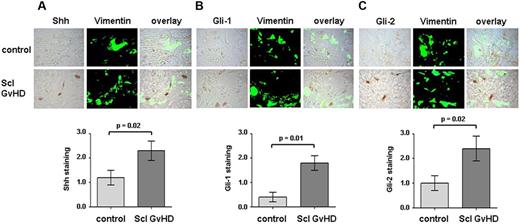 Figure 1. Hedgehog signaling is activated in human sclerodermatous cGVHD. Shh, Gli-1, and Gli-2 were detected by immunohistochemistry in skin biopsies of cGVHD patients and healthy volunteers. Fibroblasts were identified by staining with vimentin (n = 8 each). Representative examples of cGVHD patients and controls are shown at 1000-fold magnification. (A) Shh expression was strongly increased in cGVHD patients (Scl GVHD) compared with controls. (B-C) Gli-1 and Gli-2, both downstream transcription factor of the hedgehog pathway, accumulated in cGVHD patients with increased staining for Gli-1 (B) and Gli-2 (C), respectively, compared with controls.