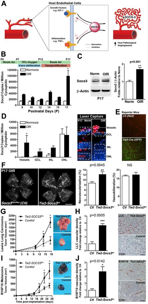 Figure 1. SOCS3 attenuates pathologic neovascularization. (A) Schematic representation of SOCS3 functioning as a negative feedback modulator of angiogenic activation. (B-C) Socs3 expression in wild-type mice exposed to OIR compared with normoxia both at the mRNA and protein level (n = 3-4). (D) Socs3 expression is significantly up-regulated in pathologic neovessels obtained by laser microdissection of retinal layers (outlined on the right; n = 4). GCL indicates ganglion cell layer; INL, inner nuclear layer; and ONL, outer nuclear layer. (E) Retinal vasculature of Cre reporter mice Rosa mTflox/mG. This strain universally expresses a red-fluorescent protein (mT) that is removed in tissues with Cre recombinase expression, revealing instead a green fluorescent protein (mGFP). In control mice, the retinal vasculature is red (top), whereas in Tie2-Cre mice, the retinal vasculature is green (bottom), demonstrating that Tie2-Cre recombinase is expressed in retinal vessels (n = 3). (F) Conditional Tie2-Socs3ko mice have more pathologic neovascularization in OIR compared with Socs3flox/flox control mice. The area of vaso-obliteration is unchanged (n = 13-34). (G,I) Increased growth of LLC (G; n = 5-7) and B16F10 melanoma tumors (I; n = 5-9) in Tie2-Socs3ko compared with Socs3flox/flox mice. (H,J) Increased tumor vessel density of LLC (H; n = 5-7) and B16F10 melanoma tumors (J; n = 5-9) in Tie2-Socs3ko compared with Socs3flox/flox mice. Scale bar in panel E indicates 200 μm; panel F, 1 mm; panels G and I, 1 cm; and in panels H and J, 100 μm. *P < .05, **P < .01, P < .001.