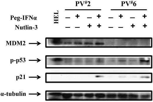 Figure 5. Low doses of Peg IFN-α 2a and Nutlin-3 increase p53 activity. Western blotting demonstrated that the phospho-p53 level in PV CD34+ cells from 2 individual patients (PV1 and PV2) was increased after treatment with low doses of Nutlin-3 combined with Peg IFN-α 2a. The p21 protein level was also increased by combination drug therapy.