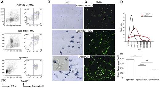 Figure 1. Inflammatory, agar-elicited neutrophils spontaneously die of NETosis ex vivo. (A) PMN cell death was evaluated by annexin V/7-AAD staining of CD11b+Gr-1+ cells. Early apoptotic cells (annexin V+/7-AAD−), apoptotic cells (annexin V+/7-AAD+), necrotic cells (annexin V−/7-AAD+), and live cells (annexin V−/7-AAD−) were identified. Representative forward scatter (FSC) and side scatter (SSC) plots are shown. (B) Activation of NADPH oxidase in PMNs from agar and in PMA-treated naive PMNs seeded onto poly-D-lysine–coated glasses. Activation of NADPH oxidase was qualitatively evaluated using the nitroblue tetrazolium (NBT) reduction test. Contrast-phase pictures obtained under a light microscope show that both agar-PMNs and naive PMNs treated with PMA produce ROS (blue precipitate). (C) Representative IF analysis shows a more efficient NETosis in agar-collected than PMA-treated spleen-derived PMNs (original magnification ×20). SYTOX green DNA dye was added to PMN after their fixation with 4% PFA. (D) Quantification of NET formation in agar-collected and PMA-treated neutrophils. Nuclear area of agar-PMN and PMA-treated neutrophils is plotted against the percentage of SYTOX-positive cells corresponding to a given nuclear area. PMNs undergoing NETosis have a broad range of nuclear areas, whereas apoptotic neutrophils show smaller nuclear areas, less distributed and composed within a narrow peak (top panel). In line, agar-PMNs showed higher mean nuclear area compared with PMA-treated spleen PMN (bottom panel). In this experiment, the SYTOX green DNA dye was added to PMNs after PFA fixation 18 hours later. Experiments comparing agar-PMNs with PMA-treated PMNs were repeated 6 times with PMNs from at least 3 donor mice each. Number of nuclei analyzed/experiment = 200.