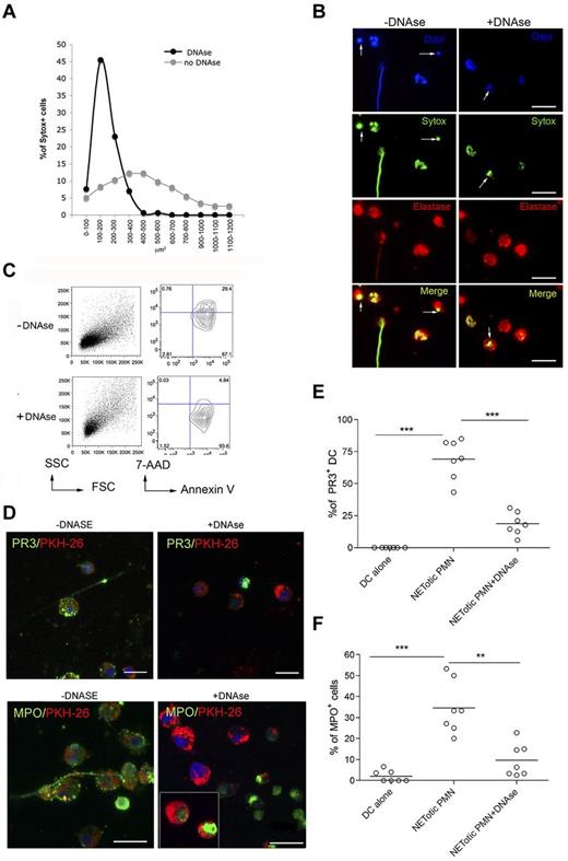Figure 3. DNAse treatment of mDC-PMN coculture abrogates DC uploading with neutrophil proteins. (A) Quantification of NET formation by agar-elicited neutrophils seeded onto poly-D-lysine–coated glasses in the presence of DNAse. Nuclear areas of PMNs are plotted against the percentage of SYTOX-positive cells corresponding to a given nuclear area. In the presence of DNAse, nuclear areas appear smaller and show a narrow peak compared with untreated PMNs in which nuclear area has a broad distribution. Number of nuclei analyzed/experiment = 200. One representative experiment of 3 performed. (B) IF analysis of agar-PMN seeded onto poly-D-lysine-coated glasses in the presence of DNAse (100 U/mL) and DNA dye SYTOX green. Twenty-four hours later, PMNs were fixed and stained with a polyclonal Ab to elastase. Scale bars represent 10 μm. One representative experiment of 3 performed is shown. (C) Forward scatter (FSC)/side scatter (SSC) and annexin V/7-AAD representative plots for CD11b+GR-1+ agar-PMNs treated or not with DNAse, showing the presence of annexin V+ apoptotic cells in agar-PMNs that have been cultured onto poly-D-lysine–coated glasses also in the presence of DNAse. (D-F) Incorporation of PR3 and MPO in mDCs was prevented by DNAse treatment. (D) Confocal microscopy analysis of mDCs (PKH-26+, red) cocultured o/n with NETotic PMN in absence (left panels) or presence (right panels) of DNAse and Abs to PR3 or MPO conjugated with Alexa-488 dye. The vital DNA dye Draq 5 (blue) shows that only the DNA of PMNs but not of DCs is degraded by DNAse. Notably, PMNs treated with DNAse retain both PR3 and MPO staining. Scale bars represent 10 μm. One representative experiment of 5 performed. Quantification of PR3 (E) and MPO (F) incorporation by mDCs performed on confocal microscopy micrographs using the software-assisted technique. Number of cells analyzed = 200. One representative experiment of 3 performed.