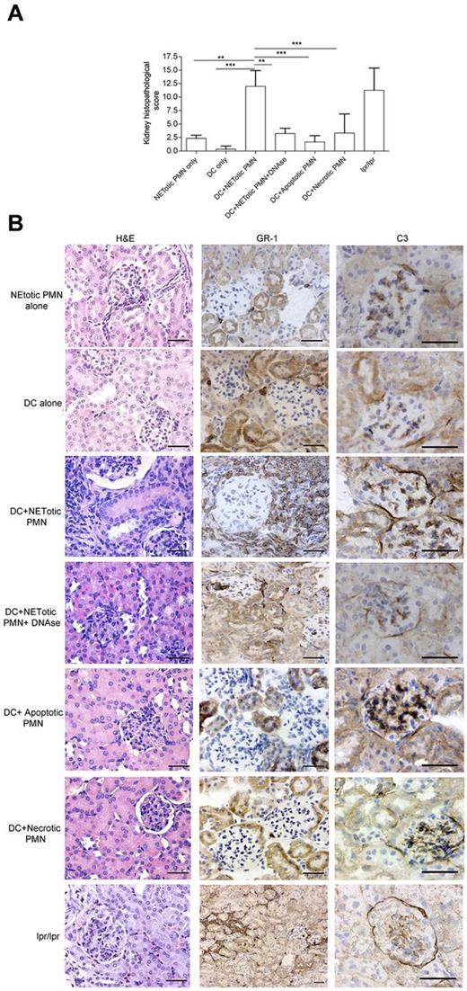 Figure 5. NET-loaded mDCs injected in mice induce renal damage. (A) Histopathologic grading of renal damage in mice immunized with mDCs loaded with NET contents, in the presence or absence of DNAse, as well as in mice immunized with mDCs loaded with apoptotic or necrotic PMNs, mDCs, or PMNs alone (n = 9/group). **P < .01 (1-way ANOVA with posttest Dunn correction). ***P < .001. Data are mean ± SD. (B) Histopathology showing renal damage in mice immunized as in panel A. Figure shows hematoxylin and eosin staining and IHC for neutrophil infiltration (GR-1 Ab), and C3 deposition. Only kidneys from mice immunized with DCs loaded with NET components showed extended parenchymal damage with vascular and periglomerular neutrophilic infiltration and complement deposition. This phenotype was prevented in mice immunized with mDCs cocultured with NETs in the presence of DNAse. One representative mouse/group. Scale bars represent 50 μm. Representative autoimmune fas mutant lpr-lpr mice used as positive control for renal damage showing the typical glomerular and interstitial nephritis.