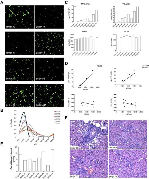 Figure 6. Correlation between NETosis, ANCAs, and autoimmune vasculitis in lupus-prone mice. (A) Spleen PMNs isolated from 8 lpr/lpr mutant mice were tested for spontaneous NETosis. PMNs were seeded onto polylysine-coated glasses without PMA or any type of stimuli, fixed and stained with the SYTOX green DNA dye. PMNs from every single mouse were imaged through confocal microscopy. Spleen purified PMNs normally die of apoptosis when cultured o/n in the absence of any stimuli (as shown in Figure 1), whereas PMNs from the same lpr/lpr mice showed enrichment in NETosis other than dying of apoptosis. Grippingly, PMNs from mice #44, 47, 48, and 50 only showed apoptosis, whereas PMNs from mice #43, 49, 52, and 54 clearly showed signs of NETosis. (B) Quantification of NET formation was performed by plotting SYTOX+ nuclear areas against the percentage of SYTOX+ cells corresponding to a given nuclear area. Number of nuclei analyzed/experiment = 200. (C) Level of MPO-ANCA, PR3-ANCA, ss-DNA, and ds-DNA Abs in the same lpr/lpr mutant mice analyzed in panel A. (D) Correlation between NETosis and MPO and PR3-ANCA. NETosis correlated with both MPO and PR3-ANCA (r2 = .9040, P = .046; and r2 = .7857, P = .0279, respectively) but not with the different types of ANA. (E) Histopathologic grading of the overall renal damage in the same lpr/lpr mutant mice described in panel A. (F) Hematoxylin and eosin staining shows intense renal tubulointerstitial lesions, particularly vasculitic lesions, in mice with higher ANCA titers (lpr/lpr 43 and 54), whereas in cases with lower ANCA titers, in which autoantibody patterns were dominated by ds- and ss-DNA ANA antibodies, glomerular nephritic lesions are prevalent (lpr/lpr 48 and 50).