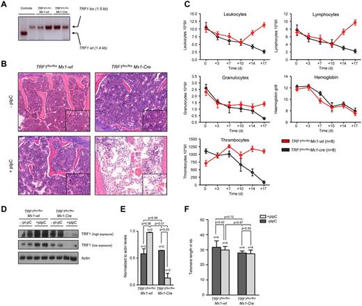 Figure 1. TRF1 deletion progressively leads to pancytopenia and histopathologically proven BMF but not to telomere shortening. (A) PCR for wild-type and floxed TRF1 confirmed the absence of remaining recipient wild-type bone marrow in TRF1flox/floxMx1-wt (lane 3 + 4) and TRF1flox/floxMx1-Cre (lane 5 + 6). Genomic control DNA of TRF1wt and TRF1flox/flox are shown (lane 1 + 2). (B) Hematoxylin and eosin staining of the sternal bone marrow of TRF1flox/floxMx1-wt and TRF1flox/floxMx1-Cre animals without Cre induction and after +18 days. Image was captured with ×10 magnification (blue bar represents 200 μm), small image shows ×40 magnification. (C) Peripheral blood counts measured twice a week of TRF1flox/floxMx1-wt and TRF1flox/floxMx1-Cre mice. No statistical difference was found at day 0 in all subpopulations between TRF1flox/floxMx1-wt and TRF1flox/floxMx1-Cre mice (all P > .05) except for thrombocytes (P = .005). At day +18, all TRF1flox/floxMx1-Cre mice showed statistically significant lower peripheral blood counts (all P < .005) except for hemoglobin levels (P = .55). Two-sided t test was used for statistical comparison. (D) Western blot analysis of TRF1 protein levels of bone marrow protein extracts of TRF1flox/floxMx1-wt and TRF1flox/floxMx1-Cre animals without pI-pC injections and after +18 days. Two different exposure times are shown. (E) Quantification of TRF1 protein levels in relation to actin protein levels (without pI-pC, dark gray bars and with pI-pC, light gray bars). Two-sided t test was used for statistical comparison. (F) Telomere length analysis using Q-FISH of sternal bone marrow sections of TRF1flox/floxMx1-wt and TRF1flox/floxMx1-Cre animals without (dark gray bars) and after 18 days of pI-pC treatment (light gray bars). Two-sided t test was used for statistical comparison.