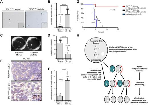 Figure 6. Mice undergoing long-term induction of TRF1 deletion undergo replicative senescence and exhaustion because of telomere shortening. (A) β-galactosidase staining of TRF1flox/floxMx1-wt and TRF1flox/floxMx1-Cre mice after 4 weeks of long-term Cre induction and 5 days of pause before measurement to exclude any interferon related effects. Images were captured with ×10 magnification, small window represents a magnified (×20) section of the image showing representative β-galactosidase–positive (indicated by black arrows) and –negative cells. (B) Quantification of β-galactosidase staining of panel A. Two-sided t test was used for statistical comparison. (C) Macroscopic view of CFA assays of TRF1flox/floxMx1-wt and TRF1flox/floxMx1-Cre mice after 12 days. (D) Quantification of CFU assay of TRF1flox/floxMx1-wt and TRF1flox/floxMx1-Cre mice after 4 weeks of long-term Cre induction and 5 days of pause before culturing. Two-sided t test was used for statistical comparison. (E) Representative IHC staining for p21 of TRF1flox/floxMx1-wt and TRF1flox/floxMx1-Cre mice being bone marrow donor for serial transplantation. Mice underwent 8 weeks of long-term Cre induction and 5 days of pause before being euthanized for serial transplantation. Image was captured with ×20 magnification (blue bar represents 100 μm), small image shows ×80 magnification. (F) Quantification of the percentage of p21-positive area calculated to the area of all cells is shown on the right. Two-sided t test was used for statistical comparison. (G) Overall survival of mice undergoing serial transplantation. TRF1flox/floxMx1-wt and TRF1flox/floxMx1-Cre bone marrow donor mice underwent 8 weeks of long-term Cre induction and had 5 days of pause before being killed as donors for serial transplantation. Both groups were compared with animals not receiving bone marrow transplantation. Log-rank test was used for comparison between TRF1flox/floxMx1-wt and TRF1flox/floxMx1-Cre mice (P = < .0005) and TRF1flox/floxMx1-Cre mice were compared with mice without bone marrow transplantation (P = .14). (H) Proposed model of the consequences of reduced TRF1 levels in patients with TIN2 mutations.