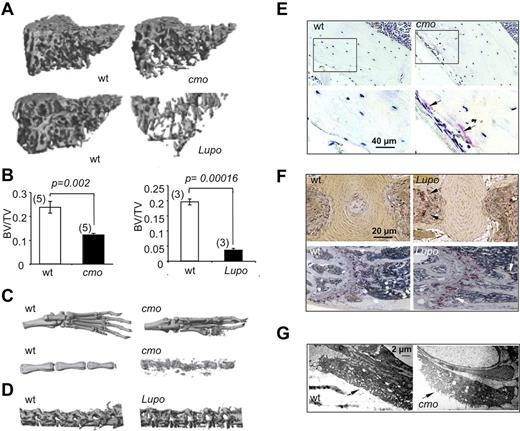 Figure 1. Diseased PSTPIP2-deficient mice are osteopenic and have erosive bone lesions that are associated with increased osteoclast numbers and activity. (A) Representative 3D reconstructions of trabecular areas of proximal tibias from PSTPIP2-deficient 3.5-month-old cmo and 3-month-old Lupo mice (right panels) and their corresponding WT control mice (left panels). (B) Quantitative micro-CT analyses of 3-month-old female mice showing that, compared with WT controls (white bars), PSTPIP2-deficient mice (black bars) have decreased proximal tibia bone volume to total volume (BV/TV). Figures in parentheses indicate the numbers of mice in each group. (C) Representative images of paws and proximal tails from cmo and WT control mice. Erosive bone lesions are seen on micro-CT reconstructions of paws and tails of diseased cmo mice. (D) Lumbar vertebrae from Lupo mice demonstrate osteopenia. (E) Increased TRAP staining in sections of femoral cortex of cmo compared with WT controls. Bottom panels are higher magnifications of the boxed regions in the top panels. (F) TRAP staining of tail vertebrae (top panels) and proximal femurs (bottom panels) of Lupo mice and WT controls. Arrows indicate TRAP+ osteoclasts. (G) Electron micrographs of vertebral osteoclasts. Arrows indicate the ruffled border.