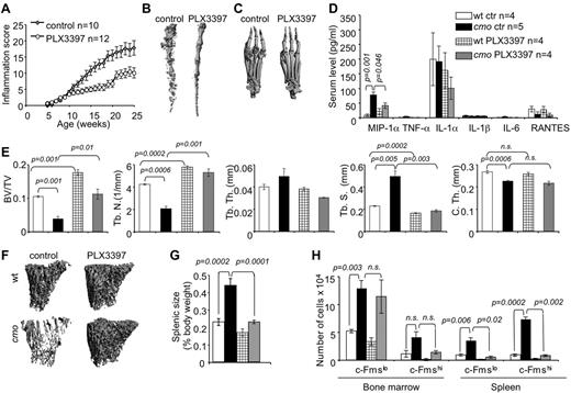 Figure 3. Inhibition of myelopoiesis using a dual c-Fms/c-Kit inhibitor attenuates inflammation and bone destruction in cmo mice. (A) Time course of disease progression in cmo mice receiving the c-Fms/c-Kit inhibitor, PLX3397 (PLX), or control chow. Treatment was started at 5 weeks of age, before the onset of clinical symptoms and continued up to ∼ 8 months of age (WT, 252 ± 18 and cmo 248 ± 19 days), at which time the mice were euthanized and analyzed. (B-C) Micro CT reconstruction of distal tails (B) and hind paws (C) of PLX-treated and control cmo mice. (D) PLX treatment decreases circulating MIP-1α in cmo mice. (E) Quantitative bone parameters of PLX-treated and control cmo and WT mice. (F) Micro CT reconstructions of proximal tibiae. (G-H) PLX treatment of cmo mice prevents splenomegaly (G) and the expansion of splenic OCP (H). Scale bars, 100 μm. Data ± SEM, n ≥ 3.