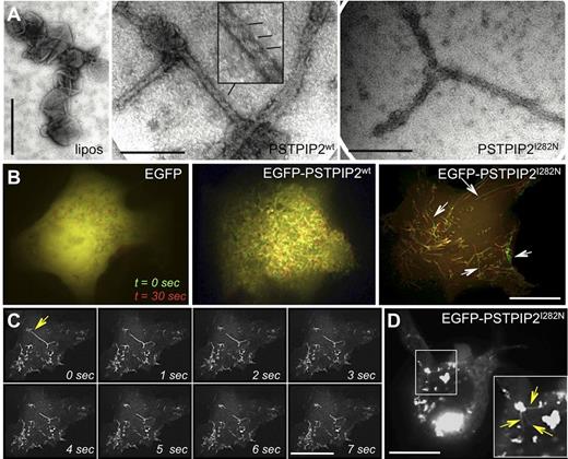 Figure 6. The I282N (Lupo) mutation impairs both membrane sculpting by PSTPIP2 and PSTPIP2 stability. (A) Transmission electron micrographs of Folch liposomes (left panel) and liposomes coincubated with WT PSTPIP2 (middle panel) demonstrate that PSTPIP2 typically generates narrow (∼ 25-nm diameter) tubules. Striations decorate some portions of the tubules (inset), suggesting a PSTPIP2 repeating scaffold. (Right panel) PSTPIP2 l282N mutation does not attenuate tubulation in vitro. (B) Mutation of I282 affects plasma membrane tubule stability. Pseudocolored fluorescence image of COS-7 cells expressing EGFP alone (left), WT EGFP-PSTPIP2 (middle) or EGFP-PSTPIP2 l282N (right) under live cell imaging. The EGFP fluorescence at time = 0 seconds is displayed in green and in the same cell 30 seconds later, in red. The lengths of PSTPIP2 l282N tubules decrease over time (arrows), whereas WT PSTPIP2 tubules appear stable, as indicated by the colocalization of red and green signals (yellow). Note: movement of tubules during the 30 seconds time frame results in separate green and red images for the same tubule. (C) Time-lapse video frames of live cell imaging of a COS-7 cell expressing EGFP-PSTPIP2 I282N at moderate levels. The arrow in the first frame denotes the site of tubule uncoating. (D) At high expression levels EGFP-PSTPIP2 I282N misfolds into large protein aggregates that are tethered to tubules (inset, arrows). Scale bars, 200 nm in panel A and 20 μm in panels B through D.