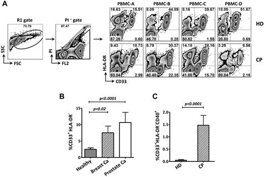 Figure 2. Differential levels of MDSCs and CD40-expressing MDSCs in PBMCs from cancer patients (CP) and healthy donors (HD). (A) Representative FACS data from 4 HDs and 4 CPs. Age-matched PBMCs from HDs and CPs were stained with antibodies, and propidium iodide (PI) was added 10 minutes before FACS analysis. R1 and PI− cell populations were gated, and the frequency of MDSCs (CD33+HLA-DR− cells) is shown in the right lower quadrant. (B) CPs had significantly higher frequencies of MDSCs in PBMCs than HDs. PBMCs from HDs (n = 30) and untreated patients with metastatic breast cancer (Breast Ca, n = 9) or metastatic prostate cancer (Prostate Ca, n = 11) were evaluated. Statistical analysis was performed using an unpaired t test. (C) Higher frequency of CD40-expressing MDSCs in CPs than in HDs. Samples used in panel B were evaluated for CD40 expression on the MDSC population. The data shown in CPs were from all CPs (9 breast Ca and 11 prostate Ca). The results shown are representative of 2 experiments. Statistical analysis was performed using an unpaired t test. FSC indicates forward scatter; and SSC, side scatter.