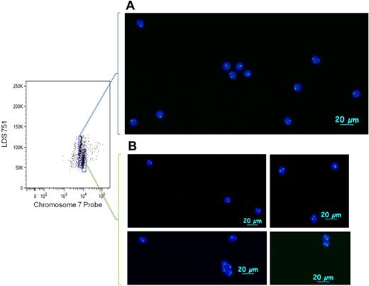 Figure 2. FACS isolation of monosomy 7 cells after IC Flow-FISH. Monosomy 7 cells (A) and normal cells (B) from PBMCs (frozen for 6 weeks after drawing) were sorted during IC Flow-FISH, stained with 4,6-diamidino-2-phenylindole, and photographed with fluorescence microscopy. Cells were sorted on a BD FACSAria II cell sorter; pictures were taken at room temperature on an Axio Imager D1 (Carl Zeiss Imaging Systems) with 20×/1.4 objective and processed by AxioVision Version 4.6.3.0 (Carl Zeiss Imaging Systems).