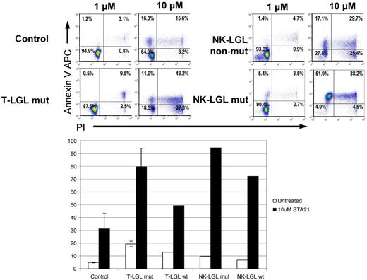 Figure 3. Effect of STA-21 on apoptosis of malignant LGLs. Leukemic and control cells were harvested after 48 hours of STA-21 treatment and analyzed with propidium iodide and annexin V staining assays. (Top) Dose-dependent increase in apoptosis. (Bottom) Histograms depicting percentage of cells undergoing apoptosis after treatment compared with untreated cells.