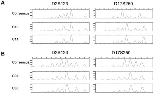 Figure 2. MSI fragment patterns show evidence of clonal evolution. Electropherograms depicting the consensus and MSI FPSs of D2S123 and D17S250 in the MSI-H CFCs of BMA 09 consensus (C9), C10, and C11 (A) or BMA 12 consensus (C06), C07, and C08 (B). Microsatellite loci not depicted are stable in these samples.