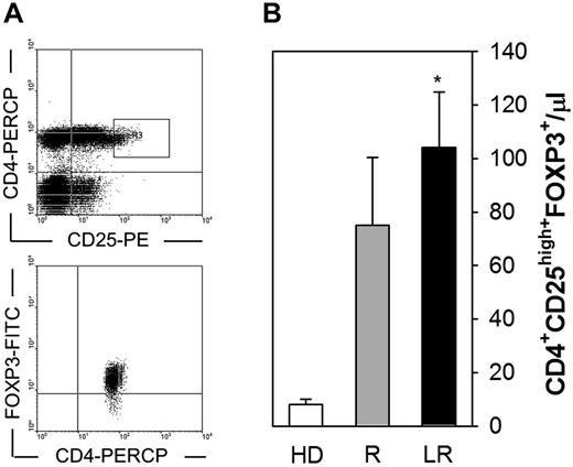 Figure 4. Treg cells are significantly expanded in LR patients. (A) Gating strategy used to quantify Treg cells. CD4+CD25high+ T cells (R3) were identified in total lymphocytes (top) and evaluated for their expression of FOXP3 (bottom). (B) Absolute numbers of circulating CD4+CD25high+FOXP3+ cells. Treg total counts were significantly greater in the peripheral blood of LR patients (n = 14) compared both with healthy donors (HD, n = 15) and R patients (n = 10; *P < .001 and P = .018, respectively). Bars represent mean values ± SEM.