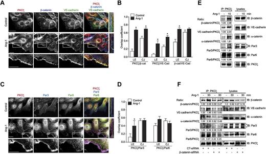 Figure 4. Ang-1 induces the colocalization of polarity and adherens junction proteins at the leading edge of migrating endothelial cells. (A) Representative immunofluorescence micrographs showing colocalization (merge; right) of β-catenin, VE-cadherin, and PKCζ at the leading edge of migrating BAEC subjected to Ang-1 stimulation (30 minutes). Scale bar represents 20 μm. Higher magnification views of the boxed region are shown. (B) Quantification of the overlap coefficient of colocalization for PKCζ/β-catenin, PKCζ/VE-cadherin or β-catenin/VE-cadherin in control (white) and Ang-1–stimulated cells (black) at the leading edge (LE) and at cell junctions (CJ). (C) Representative immunofluorescence microscopy images of BAECs stained using anti-PKCζ showing increased colocalization for PKCζ, Par3, and Par6 in Ang-1–stimulated cells (30 minutes). Higher magnification view of the boxed region is shown. Scale bar represents 20 μm. (D) Quantification of the overlap coefficient of colocalization for PKCζ/Par6, PKCζ/Par3 in control (white) and Ang-1–stimulated cells (black) at the LE and at CJ. Each column represents the average of at least 36 measurements, and data are represented as mean ± SEM (*P < .05 compared with nonstimulated cells). (E) Immunoprecipitation of endogenous PKCζ from BAECs stimulated or not with Ang-1. PKCζ immunoprecipitates and total cell lysates were subjected to Western blot analysis with anti–β-catenin, anti–VE-cadherin, anti–α-catenin, anti-Par6, anti-Par3, and anti-PKCζ antibodies. Ratios of the densitometric analyses of immunoblots are presented. (F) Immunoprecipitation of PKCz from BAECs, as in panel E, transfected with CT or β-catenin-siRNA.