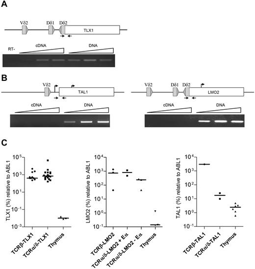 Figure 4. Analysis of the TCR-oncogene translocation. (A) Fusion transcripts from TCRδ-TLX1 (T-ALL9) were investigated by PCR and RT-PCR with a range of cDNA and DNA quantities. (B) TCRδ-LMO2 (T-ALL145) and TCRδ-TAL1 (T-ALL437) translocations were investigated by PCR and RT-PCR with a range of cDNA and DNA quantities (positions of oligonucleotide primers are indicated by arrows on upper diagrams). The absence of genomic DNA contamination in the cDNA fraction was validated by quantitative RT-PCR using albumin DNA-specific oligonucleotide primers (not shown) and a RT-negative control was performed for T-ALL9. (C) TLX1, LMO2, and TAL1 quantification by quantitative RT-PCR.