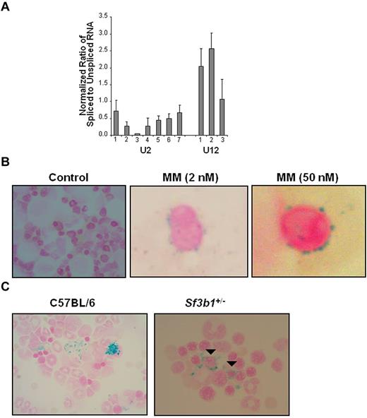Figure 2. In vitro and in vivo alterations of SF3B1 gene lead to an RARS phenotype. (A) K562 cells were transfected with shRNA constructs. After 48 hours of puromycin selection, RT-PCR assay was performed using random oligos for endogenous U2 (1-7) and U12 (1-3) introns (Table 1). The ratio of spliced to unspliced pre-mRNA for U2- and U12-dependent introns is shown. Average reaches 0.42 and 1.89 for U2-introns and U12-introns, respectively. Data are mean ± SD, calculated from 2 independent experiments. K562 transfected with vector only was used as control, and the ratio of spliced to unspliced pre-mRNA was set to 1. (B) Human colony-forming unit cell assay was performed on BM cells derived from 4 healthy persons. Cells were treated with different doses of meayamycin (2, 10, and 50nM). Representative pictures at 2 and 50nM are shown. Colonies were harvested after 2 weeks, spotted on cytospin slides, and subjected to Prussian blue staining. (C) Prussian blue staining of BM aspirates shows numerous RSs in Sf3b1+/− compared with C57BL/6 mice. Closed arrowheads indicate perinuclear RS. BM cytospin slides were kindly provided by Dr H. Koseki from Japan. Slides were analyzed using an Olympus system microscope (model BX41; objective lens, ×100; camera, SPOT Idea Model No 28.2). Images were acquired using a SPOT Imaging software by Diagnostic Instruments Inc (www.Diaginc.com).