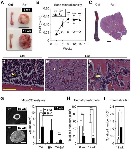 Figure 1. Changes in the BM cavity of Rs1 mice. (A) Representative photographs of femurs from 6-week-old (6 wk) and 12-week-old (12 wk) control (Ctrl) and ColI(2.3)+/Rs1+ (Rs1) mice. Scale bar represents 1 cm. (B) Dual-energy x-ray absorptiometry measurements of bone mineral density (BMD) in age-matched Ctrl and Rs1 littermates (n = 6-15 mice per group). (C-F) Hematoxylin and eosin staining of decalcified femurs from 12-weeks-old Ctrl and Rs1 mice. Low magnification (C) showing loss of the normal BM canal and gross morphologic bone changes. Scale bar represents 2 mm. High magnification showing hematopoietic BM cells and cortical bone in Ctrl (D) and Rs1 bone containing fibrous infiltrate and disorganized trabeculae (E) and hematopoietic BM cells (F) intermingled with fibrocellular infiltrate. c indicates cortical bone; bm, BM space; t, trabecular bone; and f, fibrous stromal cells. Scale bar represents 100 μm. (G) Micro-CT analysis on femurs of 15-week-old (15 wk) Ctrl (n = 4) and Rs1 (n = 5) mice. Scale bar represents 1 mm. TV and mineralized BV were determined on 50 mid-femur slices. (H) Enumeration of BM hematopoietic cell numbers released by crushing and extensive washing of bones isolated from 6-week-old and 12-week-old Ctrl and Rs1 mice (n = 6-13 per group). (I) Enumeration of BM Lin−/CD45− endosteal stromal cells released by collagenase-digestion from the crushed bones of 12-week-old control and Rs1 mice. Data are mean ± SD. *P ≤ .05. **P ≤ .01. ***P ≤ .001.