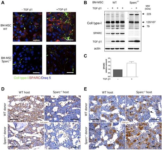 Figure 5. BM-MSCs from Sparc−/− mice are defective in collagen type I deposition despite high TGF-β1 synthesis. (A) In vitro confocal microscopic analysis for collagen type I (green) and SPARC (red) expression in BM-MSCs obtained from WT and Sparc−/− mice. BM-MSCs were seeded onto culture dishes adapted for confocal microscopy, starved for 24 hours, and then treated with recombinant TGF-β1. Untreated cells served as the control. The images show that rTGF-β1 administration induced SPARC up-regulation and collagen type I fiber deposition only in WT BM-MSCs. Results of 1 representative experiment of the 3 performed in triplicate are shown. Original magnifications ×400. Scale bars represent 50 μm. (B) Western blot analysis for collagen type I, SPARC, and TGF-β1 on whole cell lysates from BM-MSCs treated rTGF-β1. Untreated cells served as the control. Western blot analysis highlights a different pattern of collagen type I production by WT and Sparc−/− BM-MSCs. Specifically, WT BM-MSCs produce both the mature form of collagen (79 kDa) and precursors of low molecular weight (predicted molecular weight of 107-120 kDa). In contrast, Sparc−/− BM-MSCs were unable to produce the mature form of collagen (79 kDa) and accumulated precursors of high molecular weight (223 kDa), which indicates a defect in collagen maturation in Sparc−/−, but not WT, BM-MSCs. WB analysis also showed that WT BM-MSCs up-regulate SPARC expression after rTGF-β1 administration. The results of 1 representative experiments of the 3 performed in triplicate are shown. (C) Western blot quantitative analysis of SPARC expression performed on WT BM-MSCs treated with rTGF-β1. Untreated cells served as the control. The data represent 1 experiment of the 3 performed in triplicate. (D) Immunohistochemical analysis of collagen type I expression (DAB, brown signal) in BM samples from mouse chimeras showing that chimeric mice with WT stroma (WT > WT, Sparc−/− > WT) have significantly higher interstitial deposition of collagen type I (left panels, black arrows) compared with chimeras with Sparc−/− BM stroma (WT > Sparc−/−, Sparc−/− > Sparc−/−; right panels). Four representative immunostained sections (1 per group) are shown of the 20 evaluated. Original magnifications ×400. Scale bars represent 50 μm. (E) Immunohistochemical analysis of TGF-β1 expression (DAB, brown signal) in BM samples from TPO-treated mouse chimeras showing that a higher density of BM stromal cells expressing TGF-β1 (arrows) is detected in chimeras with a Sparc−/− BM stroma (WT > Sparc−/−, Sparc−/− > Sparc−/−; right panels) compared with the WT counterpart (WT > WT, Sparc−/− > WT; left panels). Four representative immunostained sections (1 per group) are shown of the 20 evaluated. Original magnifications ×400. Scale bars represent 50 μm.