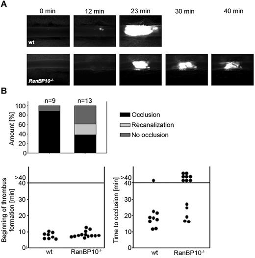 Figure 3. RanBP10−/− mice show impaired thrombus formation in an arterial thrombosis model. (A) The onset of thrombus formation after FeCl3-induced injury is unaffected (top panel). In wild-type mice vessels are occluded within 20 minutes whereas in mutant animals no stable clot is formed within 40 minutes observation time (bottom panel). (B) Quantification reveals that in wild-type mice 8 of 9 injured arterioles show normal occlusion, although this was only present in 5 of 13 arterioles of RanBP10−/− mice. In 8 of 13 arterioles we found no occlusion or recanalization within the observation time.