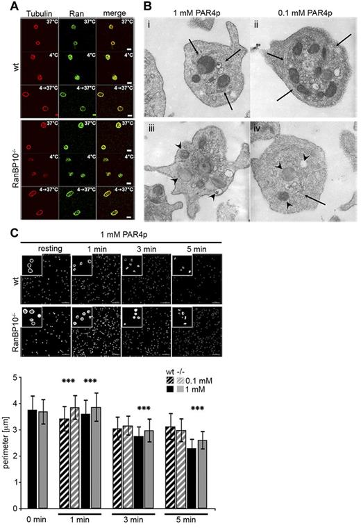 Figure 5. RanBP10 is dispensable for spontaneous microtubule polymerization but is essential for marginal band contraction after platelet activation. (A) Microtubule depolymerization and repolymerization was normal after platelet cooling and rewarming. Tubulin is stained in red (Alexa647) and Ran in green (Alexa488). (B) TEM ultragraphs of platelets treated with 1mM or 0.1mM PAR4p show that in wild-type platelets the microtubule coil contracts (arrows, i and ii) and granules become centralized. In RanBP10−/− platelets (iii and iv) the marginal microtubule band fails to contract and granules are no longer centralized (arrowheads). Normal platelet activation is shown by protrusions in either strain. Subpanel iv shows an example of disorganized microtubule filaments (arrow). (C) Immunofluorescence staining with anti–β1-tubulin antibody and quantification of fixed platelets at time-points indicated after stimulation with PAR4p (top panel). Quantification of wild-type (black) and RanBP10−/− platelets (gray) after stimulation with 0.1mM PARp (hatched bars) and 1mM PAR4p (filled bars; ***P < .001, double-sided Student t test with independent variances).