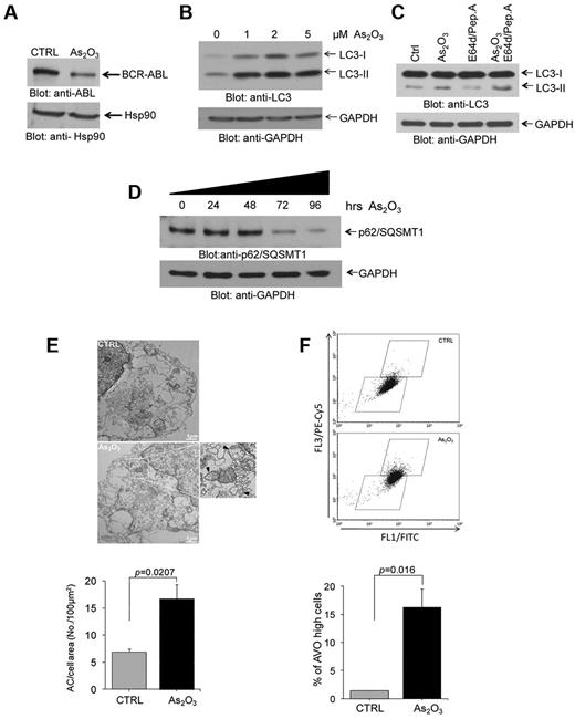 Figure 1. As2O3–dependent degradation of BCR-ABL and induction of autophagy in the BCR-ABL expressing leukemia cells. (A) K562 cells were incubated with As2O3 for 24 hours, as indicated. Total cell lysates were resolved by SDS-PAGE and immunoblotted with the indicated antibodies. (B) K562 cells were incubated with AS2O3 at the indicated final concentrations for 24 hours. Total cell lysates were resolved by SDS-PAGE and immunoblotted with anti-LC3 or anti-GAPDH antibodies, as indicated. (C) K562 cells were incubated with AS2O3 (2μM) in the presence or absence of E64d (10μM), and pepstatin A (10μM) for 24 hours, as indicated. Total cell lysates were resolved by SDS-PAGE and immunoblotted with anti-LC3 or anti-GAPDH antibodies, as indicated. (D) K562 cells were incubated for the indicated times with AS2O3 (2μM). Total cell lysates were resolved by SDS-PAGE and immunoblotted with anti-p62/SQSMT1 or anti-GAPDH antibodies, as indicated. (E) Electron microscopy analysis for autophagic compartments in untreated K562 cells or cells treated for 24 hours with As2O3 (2μM). Data from 5 independent measurements were quantitate and represent autophagic compartment (AC) accumulation in a 100μM2 cell surface area. Paired t test analysis showed P = .0207. (F) K562 cells were treated for 24 hours with As2O3 (2μM). The cells were then stained with acridine orange for quantitation of formation of acidic vesicular organelles (AVOs). An increase in AVOs formation is accompanied with an increase in FL3/PE-Cy5 fluorescence, reflecting induction of autophagy. Data from 3 independent experiments, including the one shown in the top panel, were quantitated are expressed as means ± SE. Paired t test analysis comparing AS2O3–treated cells versus control-untreated cells, demonstrated P = .016.
