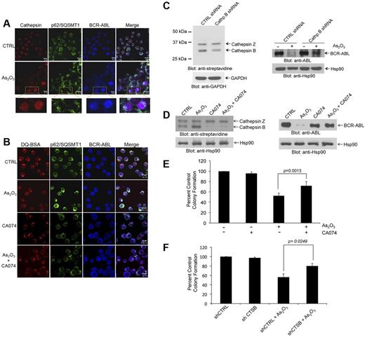 Figure 4. Cathepsin B activity is required for arsenic-induced autophagic degradation of BCR-ABL. (A) K562 cells were treated with AS2O3 (2μM) for 24 hours. The cells were then stained with a pan-cathepsin probe (Prosense 680; red), and aftercollection stained with either anti-ABL (blue) or anti-p62/SQSTM1 (green), and signals were detected by confocal microscopy. Merged panels indicate overlapping images of the 3 fluorescing signals, and magnified sections indicate colocalization of p62/SQSTM1, BCR-ABL, and cathepsins. (B) K562 cells were treated with or without As2O3 (2μM) or CA-074 (5μM) for 24 hours. The cells were then stained with quenched probe DQ-BSA (red), and after collection stained with either anti-ABL (blue), or anti-p62/SQSTM1 (red), and signals were detected by confocal microscopy. Merged panels indicate overlapping images of the 3 fluorescing signals, and arrows show the colocalization of p62/SQSTM1, BCR-ABL, and lysosomal probe DQ-BSA. (C left panel) Lysates from K562 cells stably expressing control (Ctrl)–shRNA or cathepsin B-shRNA where incubated with the biotinylated probe DCG-04 and, after resolution by SDS-PAGE, were immunoblotted with anti-streptavidin or anti-Hsp90 antibodies, as indicated. (Right panel) K562 cells stably expressing Ctrl-shRNA or Cathepsin B shRNA were treated with As2O3 (2μM) for 24 hours. Total lysates were resolved by SDS-PAGE and immunoblotted with the indicated antibodies. (D left panel) K562 cells were incubated in the presence or absence of As2O3 (2μM) and/or CA-074 (5μM) for 24 hours. Cell lysates where incubated with the biotinylated probe DCG-04, resolved by SDS-PAGE and immunoblotted with anti-streptavidin or anti-Hsp90, as indicated. (Right panel) K562 cells were incubated in the presence or absence of As2O3 (2μM) and/or CA-074 (5μM) for 24 hours. Cell lysates were resolved by SDS-PAGE and immunoblotted with the indicated antibodies. (E) K562 cells were plated in a methylcellulose assay system in the presence of either As2O3 (0.5μM) and/or CA-074 (5μM) as indicated. Data are expressed as percent control of CFU-L colony numbers for control untreated cells and represent means ± SE of 4 independent experiments. Paired t test analysis comparing the effects As2O3 in the absence or presence of CA-074 combination showed a paired P value = .0013. (F) K562 cells stably expressing control (CTRL)–shRNA or cathepsin B (CTSB)–shRNA were plated in a methylcellulose assay system in the presence of either AS2O3 (0.5μM) as indicated. Data are expressed as percent control of CFU-L colony numbers for control untreated cells and represent means ± SE of 4 independent experiments. Paired t test analysis comparing the effects AS2O3 showed a paired P value = .0249.