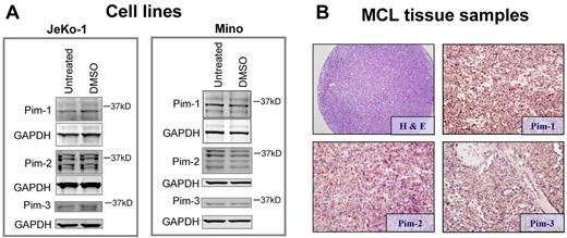 Figure 2. Expression Pim kinase protein in cell lines and lymphoma patient tissue samples. (A) Pim-1, -2, and -3 expressions in JeKo-1 and Mino cells. Cells were either untreated or treated with DMSO, and immunoblots were prepared for Pim protein expressions. Note: multiple bands in Pim-1 and Pim-2 are expected because of multiple translation initiation sites.25 (B) Histologic section of case of MCL stained with hematoxylin and eosin, and immunohistochemical staining of MCL patient tissue samples, stained with rabbit anti–Pim-1, -2, and -3 antibodies and counterstained with hematoxylin.