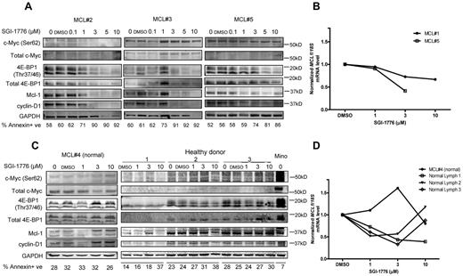 Figure 6. Effects of SGI-1776 on MCL malignant lymphocytes and normal PBMCs. Effects of SGI-1776 on phospho–c-Myc (Ser62) and total c-Myc, Mcl-1, cyclin D1 and phospho–4E-BP1 (Thr37/46), and total 4E-BP1 protein expressions in MCL malignant lymphocytes (A) and normal PBMCs from MCL patients and apparently healthy donors (C). Primary patient cells were treated with 0.1, 1, 3, 5, or 10μM, and normal PBMCs were treated with 1, 3, or 10μM SGI-1776 for 24 hours, and then cell lysates were analyzed via immunoblot. Untreated Mino cells were positive control. Apoptosis levels measured by annexin V and PI positivity is marked under each lane of the immunoblot in each primary sample. Effects of SGI-1776 on MCL1 mRNA expression levels in primary MCL malignant lymphocytes (B) and normal PBMCs from MCL patients and healthy donors (D). Primary PBMCs were treated with SGI-1776 using concentrations mentioned in this legend; RNA was isolated and analyzed using real-time RT-PCR.