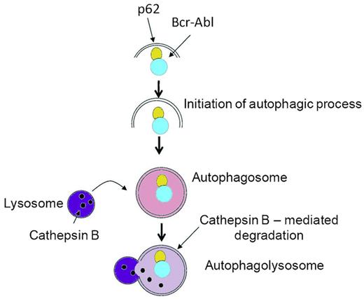 p62/SQSTM1-dependent autophagic degradation of BCR-ABL in CML. Proposed model for the As2O3-dependent interaction of p62/SQSMT1 with BCR-ABL and subsequent autophagic degradation of BCR-ABL. The As2O3 treatment of CML cells triggers the interaction of p62 with BCR-ABL and the subsequent CTSB-mediated autophagic degradation of the fusion protein that is responsible for the antileukemic effect of the drug. The inhibition of autophagy by different means (pharmacologic agents or siRNA-mediated inhibition of Atg7, p62/SQSTM1, or CTSB) impairs BCR-ABL degradation and the effect of AS2O3, demonstrating the crucial role of autophagy in the effect of As2O3. Adapted from Figure 6 in the article by Goussetis et al that begins on page 3555.