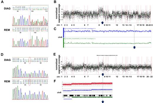 Figure 3. Sequencing coverage and SNP Array 6.0 analysis reveal copy number variations in region with RAD21 mutations. (A) DNA sequence chromatograms of tumor and remission samples show tumor-specific frameshift mutations in RAD21: insertions */+TTAG (chr8: 117866622) and */+TT (chr8: 117866620) affecting 1 RAD21 allele in a patient with t(8;21)–positive CBF-AML. (B) Analysis of the coverage variation across the genome (indicated on the horizontal axis) reveals a gain of chromosome 8 (chr 8). The coverage of the tumor sample was normalized by subtracting the coverage of the remission sample; each point corresponds to the scaled and normalized median read number in a 300-bp-wide target region. (C) SNP 6.0 copy number variation analysis confirms the diagnosis-specific gain of chr 8 in the patient. Top line (in blue) indicates plot of chr 8 from diagnosis sample; and bottom line (in green) corresponds to chr 8 in matched remission sample. (D) Somatic nonsense mutation in exon 9 of RAD21 (chr8: 117864815, c.C1294T:p.Q432X) confirmed by Sanger DNA sequencing of tumor and remission samples in a patient with CK-AML. (E) Coverage variation indicates a gain of the long arm of chr 8. The plot is generated as described in panel B. (F) 250K SNP array analysis reveals the diagnosis-specific gain on the long arm of chr 8.
