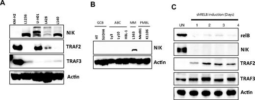 Figure 2. Stable NIK expression occurs in all assayed HL cell lines. (A) Western blot analysis of NIK, TRAF2, and TRAF3 components of the NCP in HL cell lines KM-H2, L1236, U-H01, L428, and L540. (B) Western blot analysis of NIK protein levels in GCB-DLBCL lines HT and SUDH4, ABC-DLBCL lines Ly3, Ly10, and HBL-1, MM cell line L33, and PMBL cell lines MedB1 and K1106. (C) Western blot analysis of relB, NIK TRAF2, and TRAF3 levels on induction of relB shRNA in U-HO1 HL cell line, from 1 to 4 days after shRNA induction.