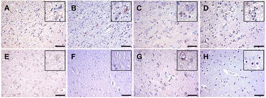 Figure 7. Inflammatory cytokines are expressed in human stroke. Immunohistochemical analysis of cytokine expression in ischemic brain tissue (A-D) and unaffected brain tissue (E-H). Immunohistochemical analysis was performed to detect CXCL-1 (A,E), CXCL-8 (B,F), TNF-α (C,G), and IFN-γ (D,H). Scale bars = 50 μm.