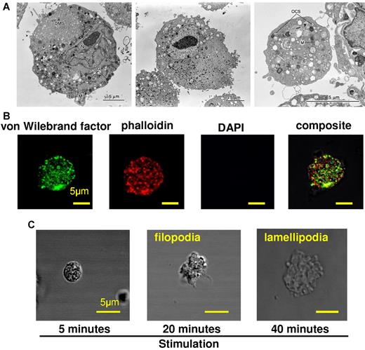 Figure 3. Morphologic analyses of iMKs and iMK-derived platelets and characterization of iMK-derived platelets. (A) Electron micrographs. (Left) An iMK derived from HDF cells transfected with p45NF-E2, Maf G, and Maf K. N indicates nucleus; G, granule; DMS, demarcation membrane system; and M, mitochondria. (Middle) A large adult HDF cell before the induction of MKs as in left panel. (Right) An iMK-derived platelet. M indicates mitochondria; and OCS, open canalicular system. Original magnification, ×2500. A 5-μm bar is included in each right lower corner. (B) Expression of VWF in iMK-derived platelets onto fibrinogen-coated glass in the presence of 10μM ADP, 10μM epinephrine, and 10μM PAR1-activating peptide. Pictures were taken with a 63× oil objective. A 5 μm bar is shown in each right lower corner. (C) Temporal sequence of an iMK-derived platelet spreading onto a fibrinogen-coated glass coverslip after activation. Pictures were taken with a 63× oil objective. A 5 μm bar is shown in each bottom right corner.