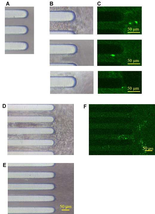 Figure 5. iMK-derived platelets into thrombus formation on a collagen chip. Representative studies of FITC-anti–human CD41 antibody-labeled blood samples from iMK-infused thrombocytopenic NOG mice perfused on a collagen-coated chip under flow condition (1000 seconds−1) for 10 minutes. (A) Collagen-coated chip before perfusion. (B) Thrombi on the collagen-coated chip after the perfusion. (C) iMK-derived platelets labeled with FITC anti–human CD41 antibody are shown in bright green fluorescence and are incorporated into the thrombi. (D) Similar to panel B but after human platelets had been infused into recipient mice. (E) Whole blood samples from irradiated and thrombocytopenic NOG mice with no infused human cells were perfused on the collagen-coated chip under flow condition (1000 seconds−1) for 10 minutes. (F) Similar to panel C but for human platelets. Original magnification, ×100, and a 50 μm bar is shown in bottom right corner of images.