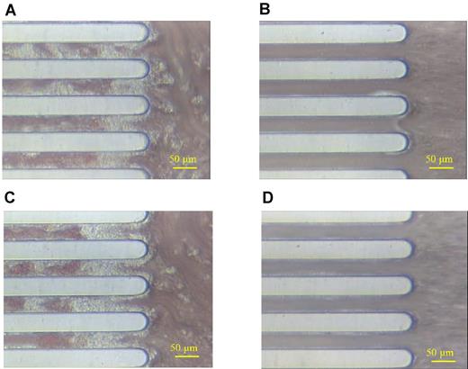 Figure 6. Active incorporation of iMK-derived human platelets into thrombi. Similar studies were done as described in Figure 5, but panels A and B are whole human blood studied on the collagen chip. Panel B has been exposed to 50 μg/mL anti–human CD42b antibody HIP1 for 20 minutes before study. (C) Similar to panel B but whole human blood has been exposed to an isotype control antibody. (D) Representative collagen chip thrombus study from NOG mice postinfusion with 5 × 105 iMKs per mouse exposed to HIP1 as in panel B. A 50 μm bar is shown in bottom right corner of each image.