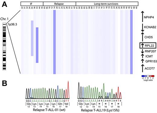 Figure 1. Deletions encompassing the RPL22 locus are observed in approximately 10% of primary T-ALL samples. (A) aCGH copy number analysis of primary T-ALL samples. Genomic DNA from primary T-ALL samples was subjected to copy number analysis as described.11 Vertical dark blue bars denote the position of the deletion. Adjacent genes and their orientation relative to the RPL22 locus are indicated on the right. (B) Sequence analysis of the RPL22 alleles of T-ALL relapse patient samples and cell lines. Representative DNA sequencing chromatograms from T-ALL cell lines with wild-type (left) or mutant (right) RPL22 alleles are depicted. The loss of a single A nucleotide in the stretch of 8 consecutive A on the mutant allele causes a shift in the translational reading frame that truncates Rpl22 after 18 amino acids.