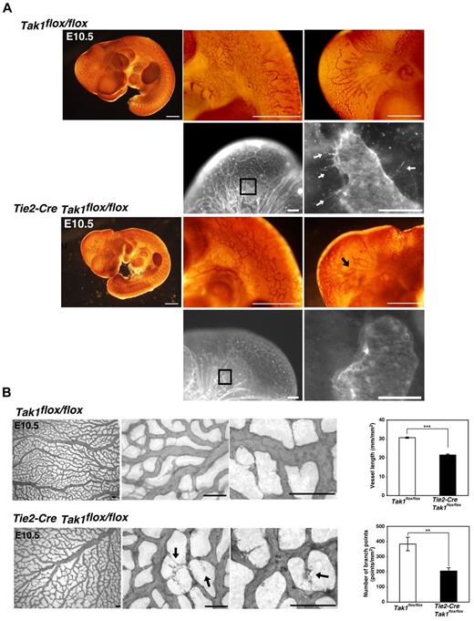 Figure 1. Endothelial-specific TAK1 deficiency impairs vascular development. (A) Whole-mount colorimetric PECAM-1 staining of control (Tak1flox/flox) and TAK1ecko (Tie2-Cre Tak1flox/flox) embryos at E10.5 (color images). Pictures are representative of 6 independent litters (n = 10). Black arrow indicates truncated vessel. Whole-mount fluorescent PECAM-1 staining of control (Tak1flox/flox) and TAK1ecko (Tie2-Cre Tak1flox/flox) are also shown (black and white images). Areas indicated in lower-magnification images are shown at a higher magnification. Arrows indicate sprouting vessels. Scale bar indicates 200 μm. (B) Whole-mount PECAM-1 staining of control (Tak1flox/flox) and TAK1ecko (Tie2-Cre Tak1flox/flox) yolk sacs at E10.5. Vessel lengths and branch points were determined in 3 randomly chosen areas from 3 different yolk sacs (graphs). Data are shown as means ± SD (n = 3). ***P < .001; **P < .01.