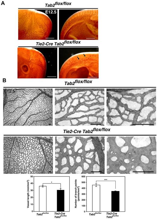Figure 5. TAB2 is important for TNF-independent TAK1 regulation of embryonic angiogenesis. (A-B) Whole-mount PECAM-1 staining of TAB2 control (Tab2flox/flox) and TAB2ecko (Tie2-Cre Tab2flox/flox) embryos and yolk sacs at E12.5. Photos show representative specimens from 4 embryos. Arrows indicate truncated vessels. Vessel lengths and branch points were determined in 3 randomly chosen areas from 3 different yolk sacs (graphs). Data are shown as means ± SD (n = 3). Scale bar indicates 200 μm in embryos, 80 μm in yolk sacs. ***P < .001; *P < .05.