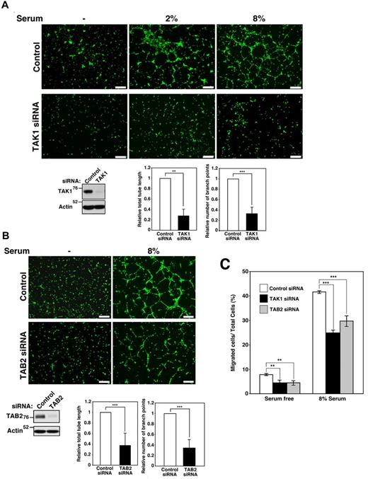 Figure 7. TAK1 signaling is important for tube formation and endothelial cell migration. (A) HUVECs were treated with control siRNA or siRNA targeting Tak1. Tube formation was observed with increasing concentrations of serum after 10 hours. Scale bar indicates 50 μm. Cells were visualized by Calcein AM, and total lengths of all formed tubes and branch points were measured. The lengths and branch points in TAK1-knockdown cells relative to those in controls are shown. Data are shown as means ± SD (n = 3). ***P < .001; **P < .01. The levels of TAK1 protein were analyzed by immunoblot. (B) HUVECs were treated with control siRNA or siRNA targeting Tab2. Tube formation was observed in response to serum after 10 hours. Scale bar indicates 50 μm. Total lengths of all formed tubes and branch points were measured, and the lengths and branch points in TAB2-knockdown cells relative to those in controls are shown. Data are shown as means ± SD (n = 5). ***P < .001 The levels of TAB2 protein were analyzed by immunoblotting. (C) The migration of TAK1- and TAB2-knockdown HUVECs was assayed using Transwells coated with collagen type 1. HUVECs were suspended in the medium and seeded in the upper chamber and the medium with or without 8% serum was added to the lower chamber. Cells were allowed to migrate across an 8.0-μm pore size membrane for 6 hours and stained with DAPI and the percentages of migrating cells in the total cell population were determined. Data are shown as means ± SD (n = 4). ***P < .001; **P < .01.
