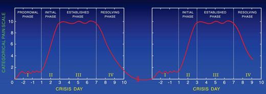 Figure 2. Two sequential painful crises with no pain during the time in between them.