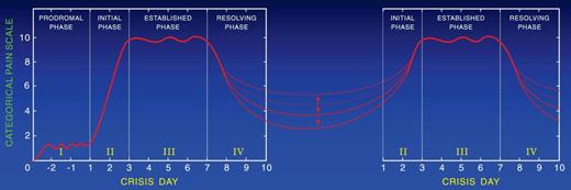 Figure 4. Two sequential painful crises with residual pain of variable severity during the time in between them.