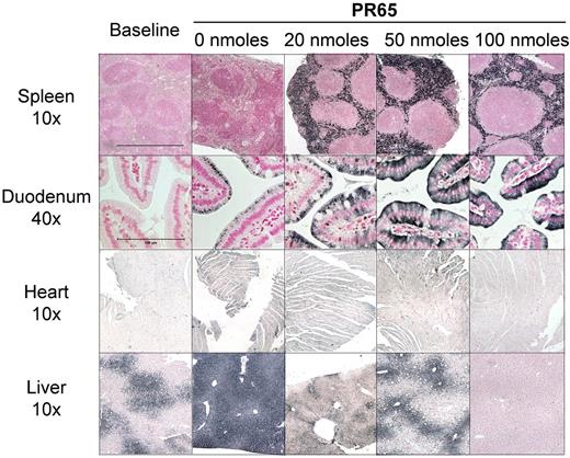 Figure 5. Cellular distribution of iron after 2 weeks of PR65 injections for the prevention of iron overload. Representative images are shown. Horizontal bars indicate 400 μm (10 ×) and 100 μm (40 ×). Iron accumulation was seen in the splenic red pulp of PR65–treated mice but not solvent-treated mice. Similarly, iron accumulation in duodenal enterocytes was seen only in PR65-treated mice. Compared with heart iron staining of solvent-injected mice, there was less iron accumulation in the heart of animals injected with 50 and 100 nmol of PR65, consistent with the quantitative method in Figure 4. Liver iron loading in mice treated with 20 and 50 nmol of PR65 was similar to that of the baseline group and much less than the iron loading in the solvent-treated group. At the highest PR65 dose, liver iron was lower than at baseline indicating that mice were able to mobilize liver iron despite high minihepcidin activity.