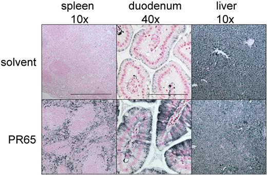 Figure 7. Cellular distribution of iron after 2 weeks of PR65 injections for the treatment of established iron overload. Tissue sections correspond to the animals analyzed in Figure 6, with representative images shown. Horizontal bars indicate 400 μm (10 ×) and 100 μm (40 ×). Enhanced Perls stain confirmed that splenic macrophages and duodenal enterocytes retained iron in PR65-treated but not in solvent-treated mice. Compared with solvent-treated controls, less intense iron staining was observed in the liver of mice treated with PR65. No consistent differences between solvent and PR65-treated mice were seen in sections of the heart (not shown).
