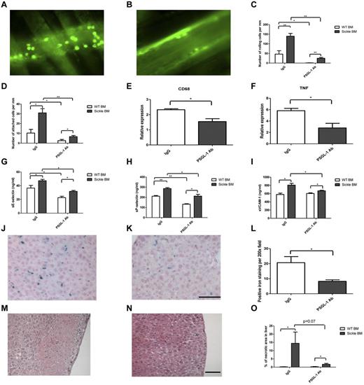 Figure 1. Effect of Psgl-1 antibody treatment on SCD. Representative intravital microscopy images of venules from Hbbhβs/hβs BMT mice that received either IgG (A) or PSGL-1 (B) Ab injections. Number of rolling (C) or attached (D) cells per mm. Transcription level of CD68 (E) and TNF-α (F) of liver tissues. Panels G-I are levels of circulating adhesion molecules, (sE-sel, sP-sel, and sVCAM-1). Representative micrographs of liver sections from Hbbhβs/hβs BMT mice receiving IgG, (J,M); or PSGL-1 Ab injection (K,N). Panels J and K are iron staining, panels M and N are H&E staining. (L) Quantification of iron deposition and (O) % of necrotic area from liver sections. *P < .05. **P < .001. N = 4-5 per group. Magnification is 200×, bar = 100 μm.